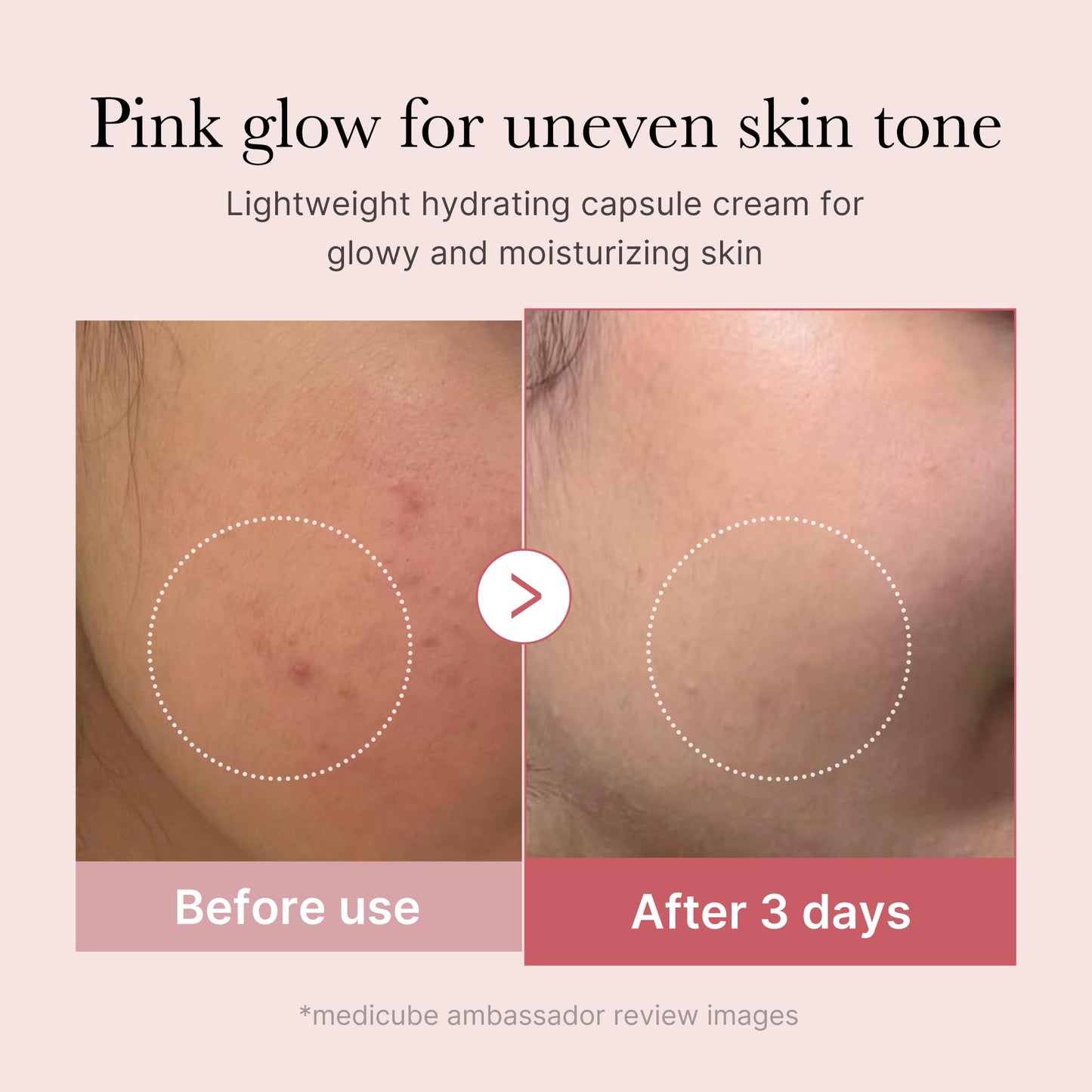Salmon DNA PDRN Skincare Set – Peptide Serum & Collagen Capsule Cream for Firm, Plump & Radiant Skin