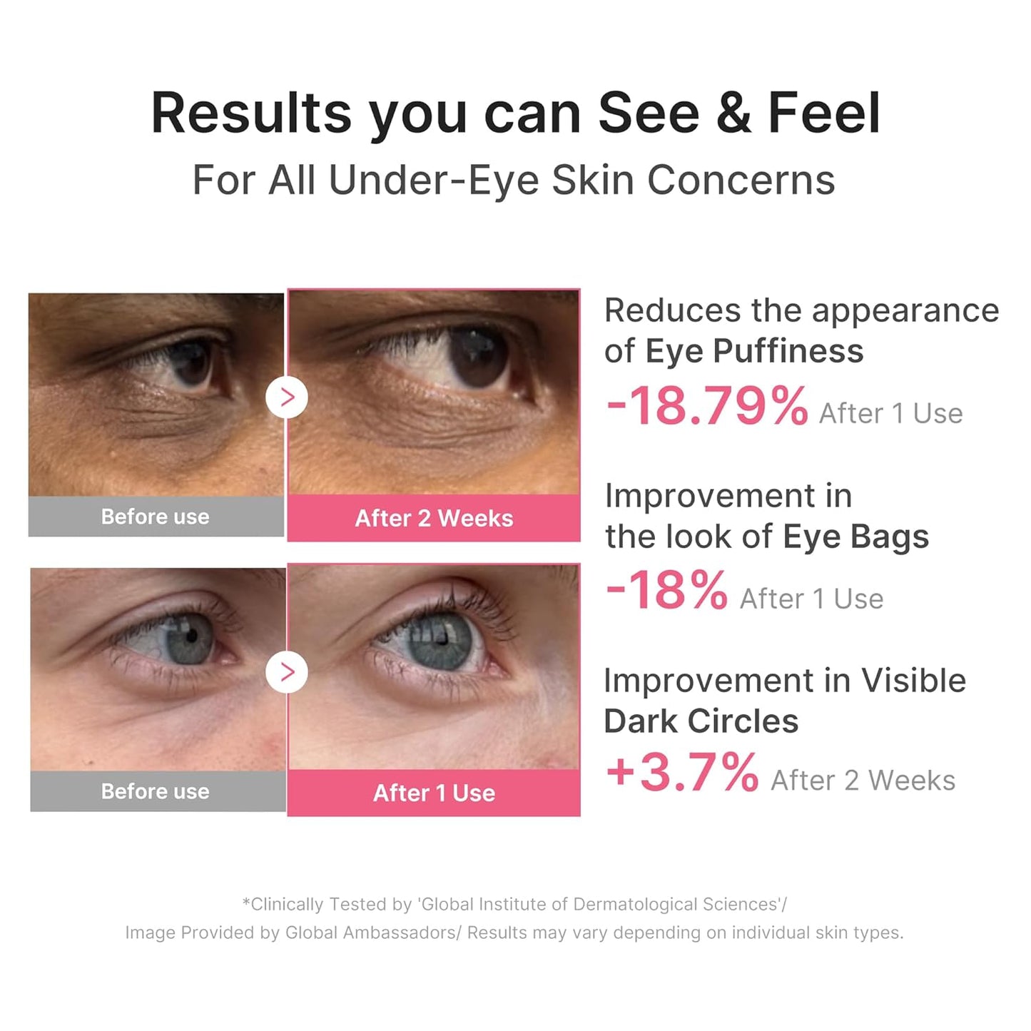 Age-Defying Collagen Eye Patches – Firming Gel Eye Masks with PDRN, Caffeine & Retinol for Brighter Under Eyes