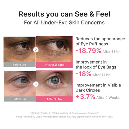 Age-Defying Collagen Eye Patches – Firming Gel Eye Masks with PDRN, Caffeine & Retinol for Brighter Under Eyes